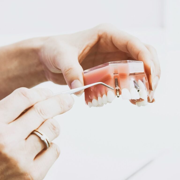 dental-implants